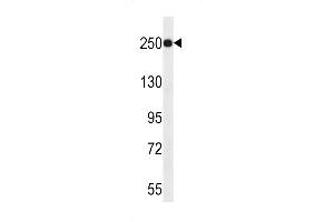 JARID1A Antibody (C-term) (ABIN656192 and ABIN2843346) western blot analysis in uterus tumor cell line lysates (35 μg/lane). (KDM5A Antikörper  (C-Term))