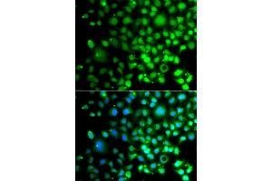 Immunofluorescence analysis of A549 cell using SMAD9 antibody. (SMAD9 Antikörper)