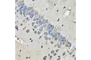 Immunohistochemistry of paraffin-embedded rat brain using MYH1 Antibody (ABIN5974170) at dilution of 1/100 (40x lens). (MYH1 Antikörper)