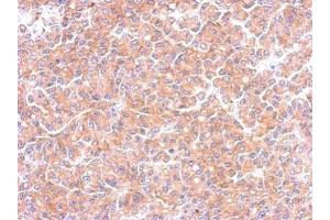 IHC-P Image Immunohistochemical analysis of paraffin-embedded RF48 xenograft, using EML1, antibody at 1:500 dilution.