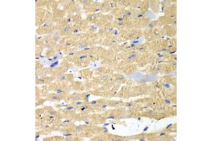 Immunohistochemistry of paraffin-embedded mouse heart using HAX1 antibody (ABIN5973233) at dilution of 1/100 (40x lens). (HAX1 Antikörper)