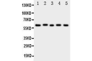 Western blot analysis of ASIC3 using anti- ASIC3 antibody . (ASIC3 Antikörper  (N-Term))