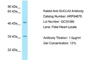 Western Blotting (WB) image for anti-Succinate-CoA Ligase, ADP-Forming, beta Subunit (SUCLA2) (N-Term) antibody (ABIN2789920) (SUCLA2 Antikörper  (N-Term))