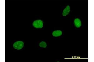 Immunofluorescence of purified MaxPab antibody to APEX2 on HeLa cell. (APEX2 Antikörper  (AA 1-518))