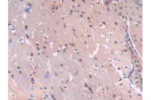 IHC-P analysis of Mouse Brain Tissue, with DAB staining. (C6orf150 Antikörper  (AA 211-395))