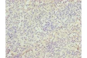 Immunohistochemistry of paraffin-embedded human spleen tissue using ABIN7171726 at dilution of 1:100 (ZBTB48 Antikörper  (AA 1-280))