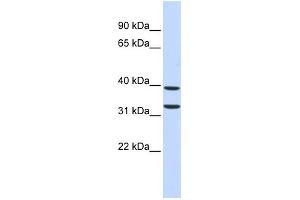 WB Suggested Anti-ZNF177 Antibody Titration:  0. (ZNF177 Antikörper  (Middle Region))