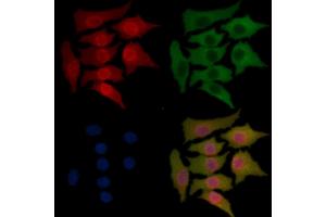 IRAK1 Mouse Monoclonal Antibody staining Hela cells by IF/ICC.