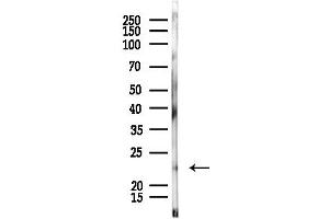 Western blot analysis of lysates from Rat liver, using RRAS2 Antibody at 1/1000 dilution.