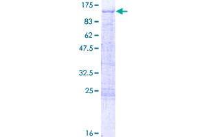 TBX2 Protein (AA 1-702) (GST tag)