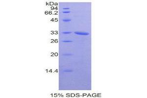 SDS-PAGE (SDS) image for NIMA (Never in Mitosis Gene A)-Related Kinase 2 (NEK2) (AA 148-397) protein (His tag) (ABIN1878132)