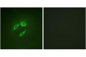 Immunofluorescence analysis of A549 cells, using SEK1/MKK4/JNKK1 (Ab-257) Antibody. (MAP2K4 Antikörper  (AA 223-272))