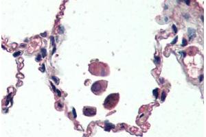 Human Lung (formalin-fixed, paraffin-embedded) stained with UCP2 antibody ABIN461943 at 3.