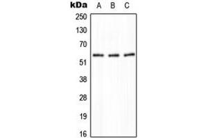 Western blot analysis of PPP2R5A expression in HeLa (A), NIH3T3 (B), H9C2 (C) whole cell lysates. (PPP2R5A Antikörper  (Center))