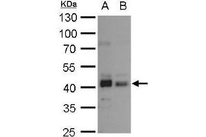 WB Image Bmi1 antibody detects Bmi1 protein by western blot analysis. (BMI1 Antikörper  (Center))