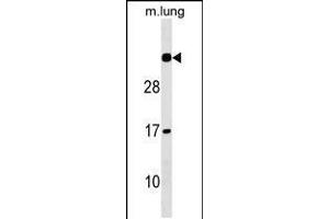 Western blot analysis in mouse lung tissue lysates (35ug/lane). (NAT15 Antikörper  (AA 133-160))