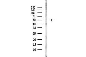 Western blot analysis of lysates from HepG2 cells(LPS, 4h treatment), using HTR3B Antibody at 1/1000 dilution.