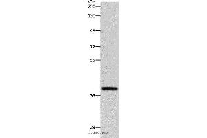 Western blot analysis of RAW264. (Reticulon 4 Antikörper)