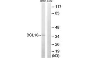 Western blot analysis of extracts from K562 cells, using BCL10 Antibody. (BCL10 Antikörper  (AA 111-160))