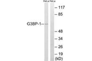 Western blot analysis of extracts from HeLa cells, using G3BP-1 (Ab-232) Antibody. (G3BP1 Antikörper  (AA 199-248))