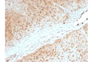 Formalin-fixed, paraffin-embedded human Pancreas stained with AKT1 Mouse Monoclonal Antibody (AKT1/2552). (AKT1 Antikörper  (AA 85-189))