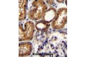 WT1 Antibody (Center E361) immunohistochemistry analysis in formalin fixed and paraffin embedded human kidney tissue followed by peroxidase conjugation of the secondary antibody and DAB staining. (WT1 Antikörper  (Middle Region))