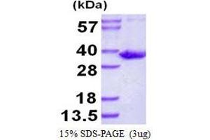 Image no. 1 for Sulfotransferase Family 1B Member 1 (SULT1B1) protein (His tag) (ABIN1098281) (SULT1B1 Protein (His tag))
