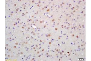 Formalin-fixed and paraffin embedded rat brain labeled with Anti-ZNF312 Polyclonal Antibody, Unconjugated (ABIN1386712) at 1:200 followed by conjugation to the secondary antibody and DAB staining (FEZF2 Antikörper  (AA 10-120))