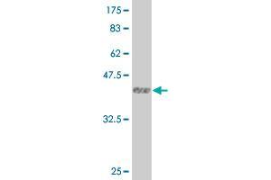 Western Blot detection against Immunogen (36. (LMTK3 Antikörper  (AA 1151-1250))