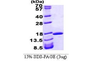 SDS-PAGE (SDS) image for Fatty Acid Binding Protein 2, Intestinal (FABP2) (AA 1-132) protein (His tag) (ABIN666760) (FABP2 Protein (AA 1-132) (His tag))