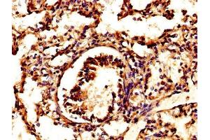 IHC image of ABIN7164840 diluted at 1:500 and staining in paraffin-embedded human lung tissue performed on a Leica BondTM system. (Prosaposin Antikörper  (AA 311-391))