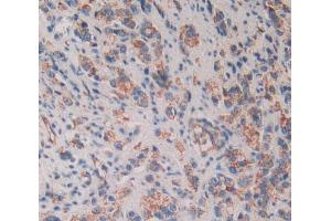 Used in DAB staining on fromalin fixed paraffin- embedded prostate gland cancer tissue (CD109 Antikörper  (AA 1146-1390))
