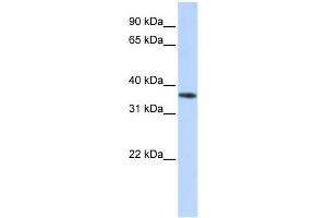 WB Suggested Anti-OR13C5 Antibody Titration: 0. (OR13C5 Antikörper  (Middle Region))