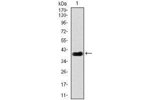 Western blot analysis using DLL4 mAb against human DLL4 (AA: 313-439) recombinant protein. (DLL4 Antikörper)