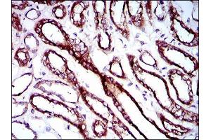Immunohistochemical analysis of paraffin-embedded kidney tissues using RPL18A mouse mAb with DAB staining. (RPL18A Antikörper  (AA 50-176))