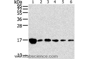 Western blot analysis of Raji, K562, A549, hepg2, PC3 and hela cell, using RPLP2 Polyclonal Antibody at dilution of 1:800 (RPLP2 Antikörper)