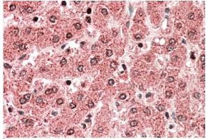 AP22390PU-N ALDH5A1 antibody staining of paraffin embedded Human Liver at 5 µg/ml. (ALDH5A1 Antikörper  (Internal Region))