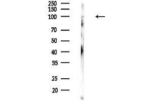 Western blot analysis of lysates from PC12 cells(LPS,4h treatment), using CHSY1 Antibody at 1/1000 dilution.