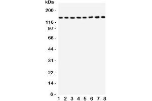 Western blot testing of TSC1 antbody and rat samples: 1. (TSC1 Antikörper  (C-Term))