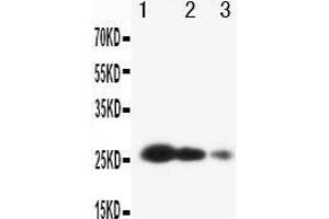 Anti-TIMP3 antibody, Western blotting Lane 1: Recombinant Human TIMP3 Protein 10ng Lane 2: Recombinant Human TIMP3 Protein 5ng Lane 3: Recombinant Human TIMP3 Protein 2. (TIMP3 Antikörper  (C-Term))