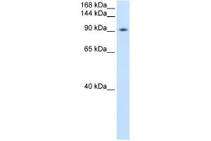 WB Suggested Anti-DDX54 Antibody Titration:  0. (DDX54 Antikörper  (C-Term))