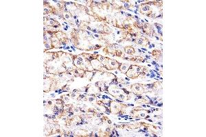 Paraformaldehyde-fixed, paraffin embedded human stomach tissue, Antigen retrieval by boiling in sodium citrate buffer (pH6. (E-cadherin Antikörper)