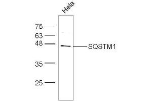 HeLa cell lysates probed with Anti-SQSTM1 Polyclonal Antibody, Unconjugated  at 1:5000 for 90 min at 37˚C.