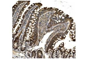 IHC analysis of Aconitase 1/ACO1 using anti-Aconitase 1/ACO1 antibody (ABIN7598988).
