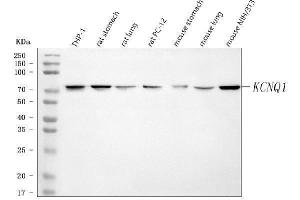 Western blot analysis of KCNQ1 using anti-KCNQ1 antibody (ABIN4886647).