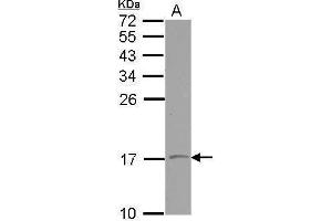 WB Image Sample (30 ug of whole cell lysate) A: NT2D1 15% SDS PAGE antibody diluted at 1:500 (VAMP1 Antikörper)