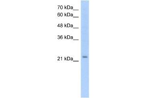 WB Suggested Anti-EMP2 Antibody Titration:  1. (EMP2 Antikörper  (Middle Region))