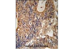 Immunohistochemistry (Paraffin-embedded Sections) (IHC (p)) image for anti-Glutathione S-Transferase pi 1 (GSTP1) (AA 97-126) antibody (ABIN1881393)