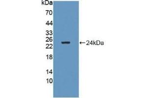 Detection of Recombinant GM2A, Human using Polyclonal Antibody to GM2 Ganglioside Activator (GM2A) (GM2A Antikörper  (AA 24-193))