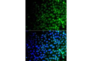 Immunofluorescence analysis of  cells using ULK4 antibody (ABIN6132771, ABIN6149925, ABIN6149926 and ABIN6223359). (ULK4 Antikörper  (AA 1-290))